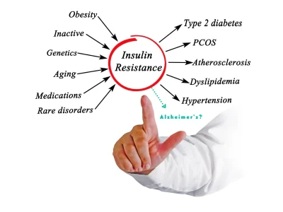 Medications for Insulin Resistance