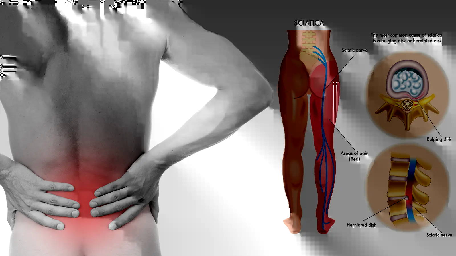 hip-pain-radiating-down-leg-causes-relief-tips-father-fitness-blog