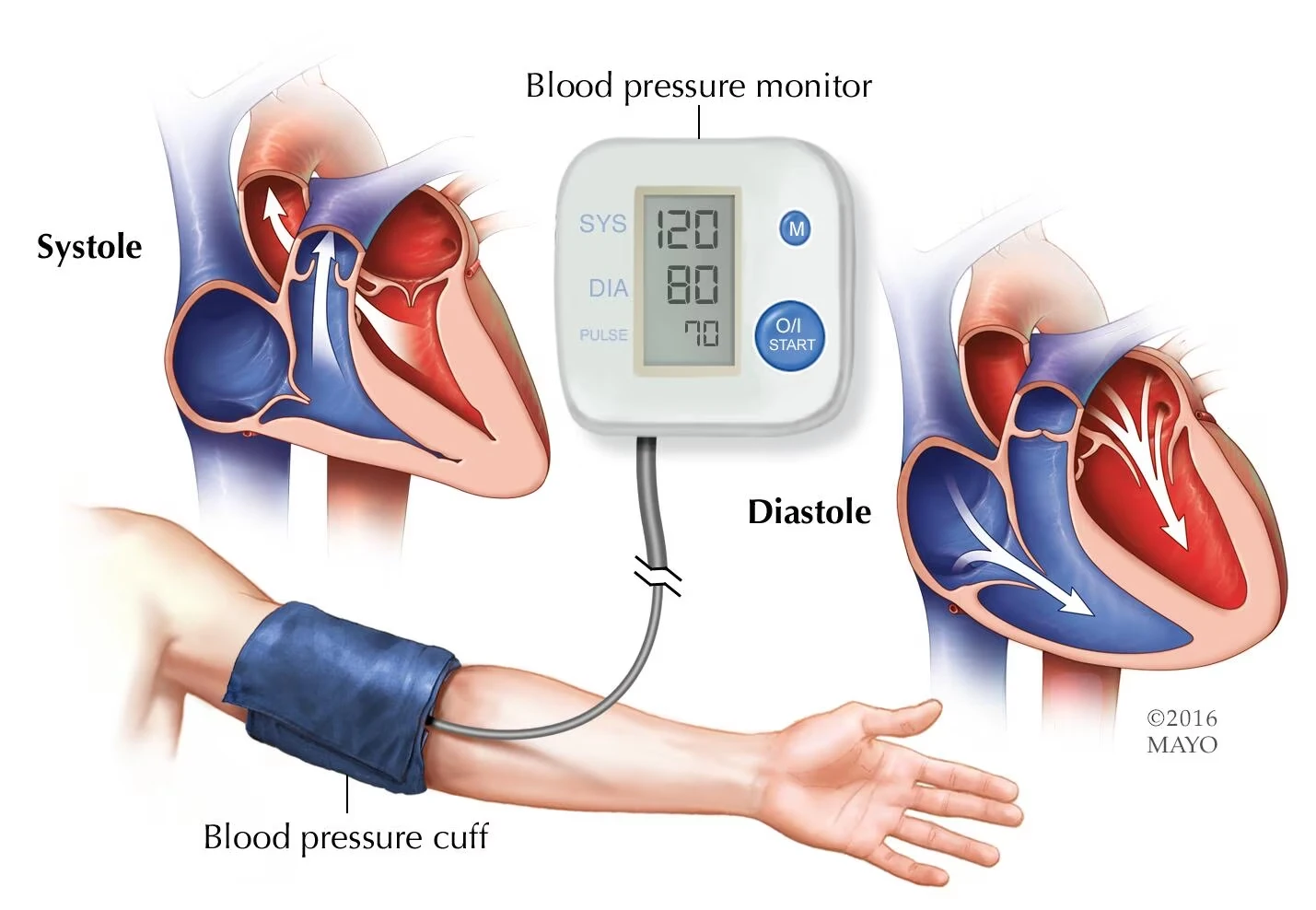 can-pain-cause-high-blood-pressure-exploring-the-6-connection